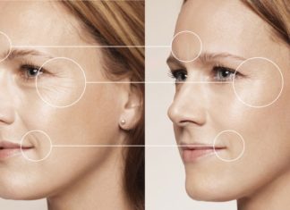 Контурная пластика лица филлерами: порядок проведения