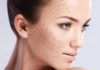 Подтяжка бровей и лба: особенности проведения процедуры