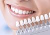 Особенности процедуры протезирования зубов