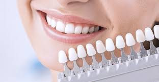 Особенности процедуры протезирования зубов