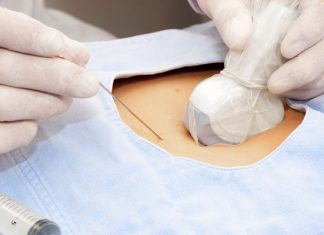 Роль биопсии в диагностике онкозаболеваний